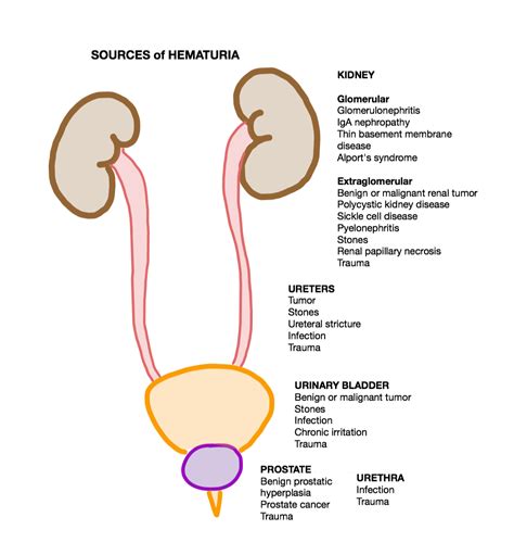 Hematuria Causes, Symptoms | Homeopathic Treatment