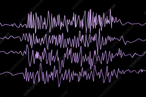 Brain waves in epilepsy, illustration - Stock Image - F021/3563 ...