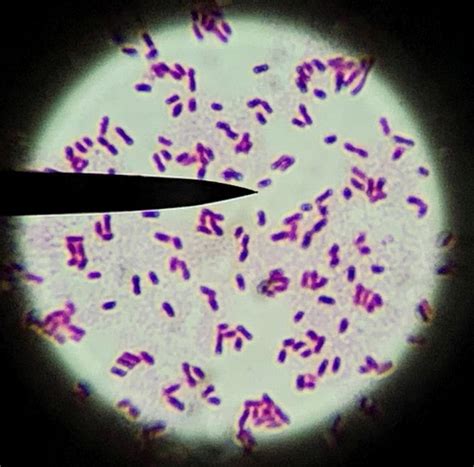 Bacterial Flagella Microscope