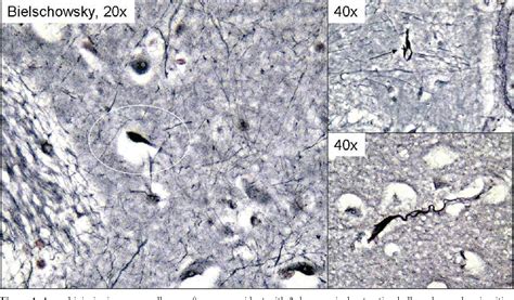 Figure 1 from Detection of diffuse axonal injury in forensic pathology | Semantic Scholar