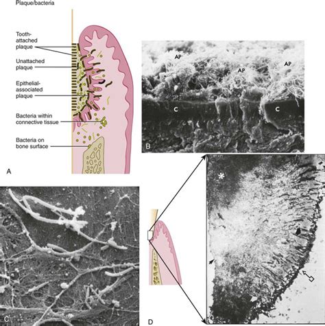 8: Biofilm and Periodontal Microbiology | Pocket Dentistry