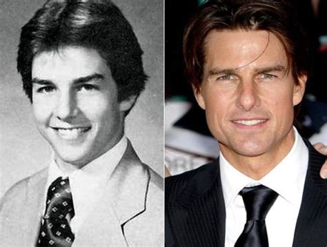 Tom Cruise before and after plastic surgery 05 – Celebrity plastic ...