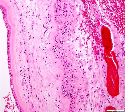 Placenta Amnion Histology | The Best Porn Website