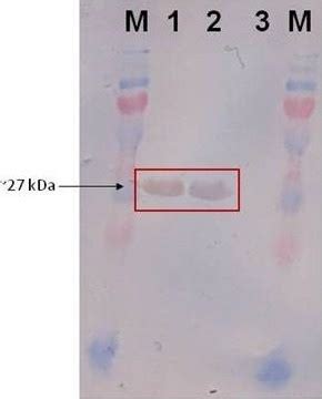 Western blot analysis. Lanes M: PageRuler™ Plus Prestained Protein ...