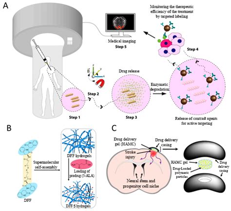 Gels | Free Full-Text | Stimuli-Responsive Hydrogels for Local Post-Surgical Drug Delivery