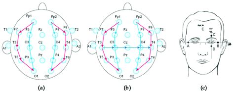 (a) Longitudinal bipolar montage for EEG signals [31], (b) transverse... | Download Scientific ...