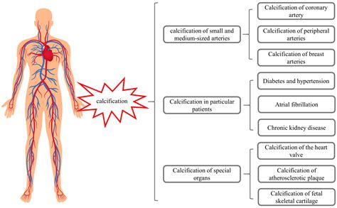 Warfarin-Induced Calcification: Potential Prevention and Treatment Strategies