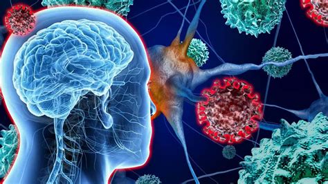 UK-wide study describes the neurological complications in COVID-19 patients - https://debuglies.com