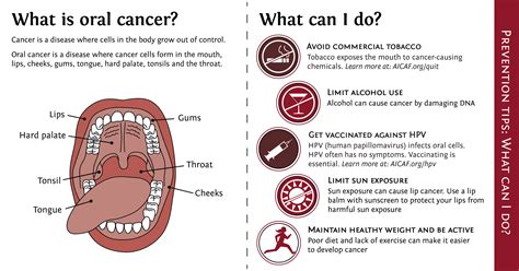 Find Out Why an Oral Cancer Screening is Really Important