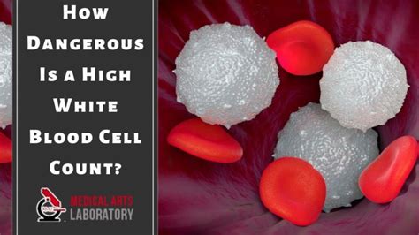 How Dangerous Is a High White Blood Cell Count?