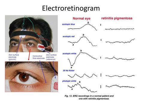 PPT - Review of anatomy & physiology of the Retina PowerPoint Presentation - ID:2161220