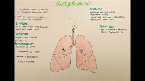 Histoplasmosis - pathophysiology, histology, clinics - YouTube