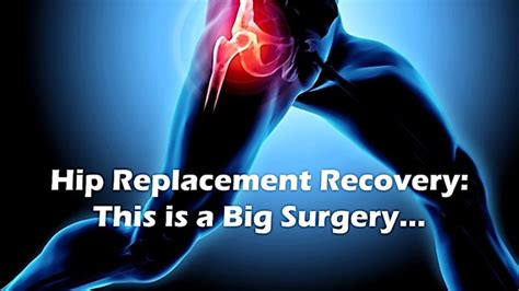 Hip Replacement Recovery: What To Know & What To Expect