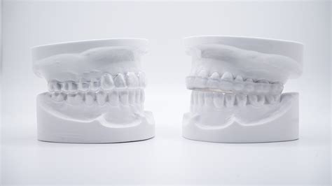 Retainer vs Night Guard for Teeth Grinding - Pro Teeth Guard