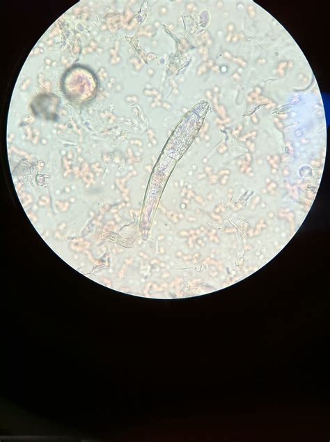 RESCUE A BOXER: Demodex Mite under the Microscope