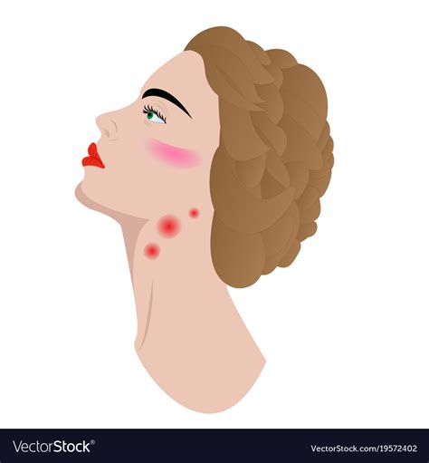 Swollen lymph nodes in womans neck Royalty Free Vector Image