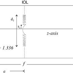 Pseudophakic model eye ( a Z distance from the IOL plane to the corneal... | Download Scientific ...