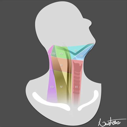 Lymph node levels of the neck | Radiology Reference Article | Radiopaedia.org