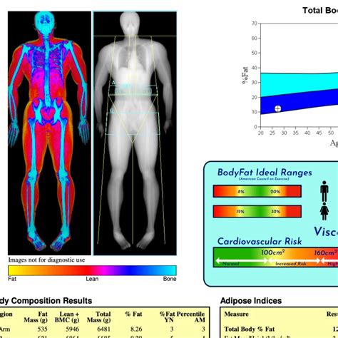 How to read a DEXA Scan - The Food TeacherThe Food Teacher