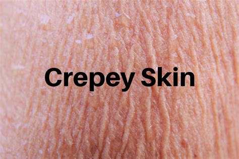 Crepey Skin: Common Causes and How to Tackle It | Sokörpe Laboratories ...