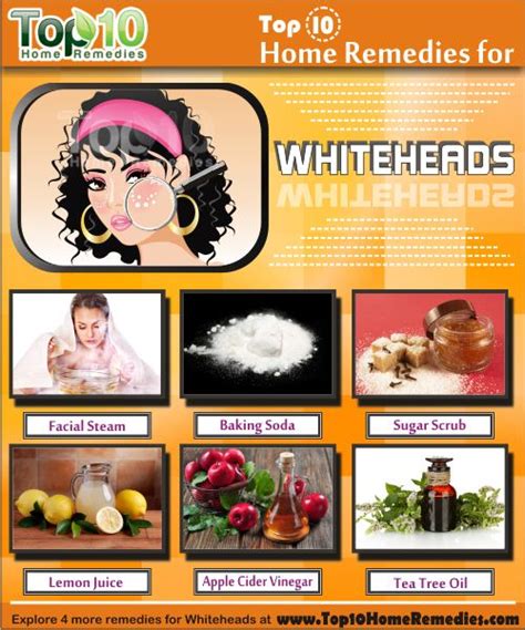 Home Remedies for Whiteheads | Top 10 Home Remedies | Whiteheads, Skin care pimples, Home remedies