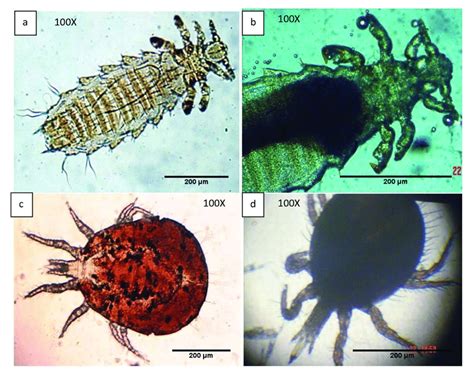 Ectoparasite Anoplura, parasitic (a) P. spinulosa morphology mounted ...