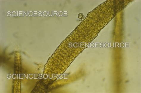 Phaeophyta Microscope