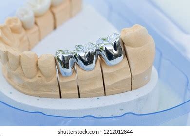 971 Artificial Dentition Images, Stock Photos & Vectors | Shutterstock