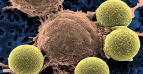 Training immune system to fight cancer comes of age - Home - DAWN.COM