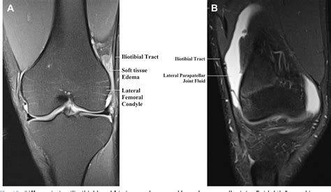 Figure 5 from Normal MR imaging anatomy of the knee. | Semantic Scholar