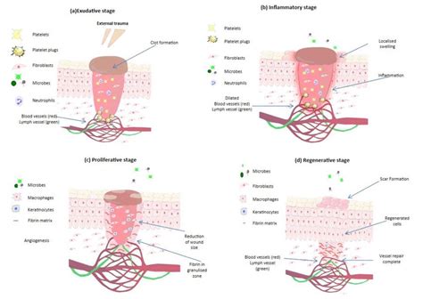 Illustration of the stages of wound healing: (a) exudative stage with... | Download Scientific ...