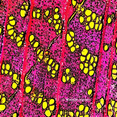 Microscopy Wood | Microbus Microscope Educational Website