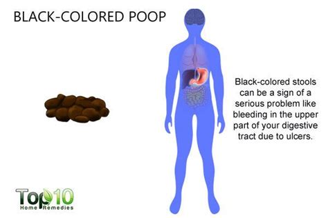 What Your Poop Says about Your Health | Top 10 Home Remedies