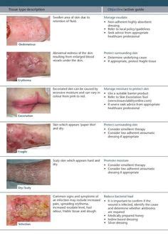 Pin on Wound care