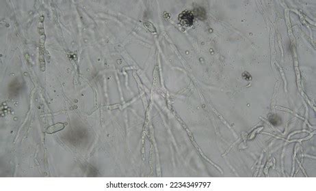 1,618 Fungal Hyphae Microscope Images, Stock Photos & Vectors ...