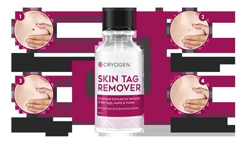 In 5 Best Skin Tag Remover -Cryogen Skin Tag Remover Reviews