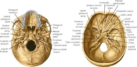 Skull base anatomy and CSF rhinorrhea. | Semantic Scholar