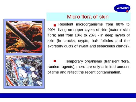 1 ASEPSIS AND ANTISEPSIS History of surgery