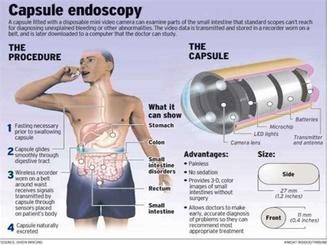 Investigations in lower gastrointestinal bleed