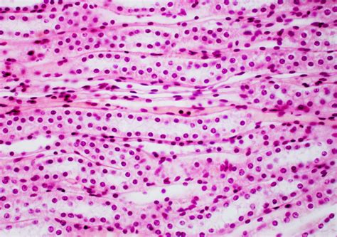 epithelial tissue -- simple cuboidal epithelium, kidney, longitudinal section Diagram | Quizlet