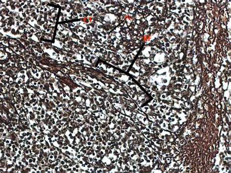 Reticular Connective Tissue 20x | Histology