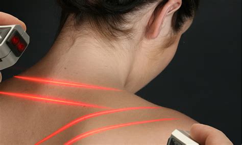 Benefits of Low-Level Laser Therapy - Vitality Chiropractic