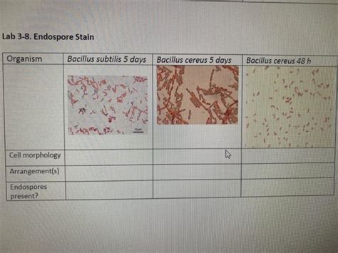 Solved Lab 3-8. Endospore Stain Organism Bacillus subtilis 5 | Chegg.com