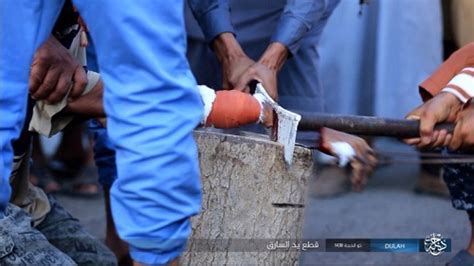 Man's Hand Publicly Cut Off for Allegedly Stealing (Graphic Photos)