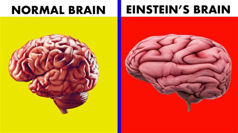 Albert Einstein Brain