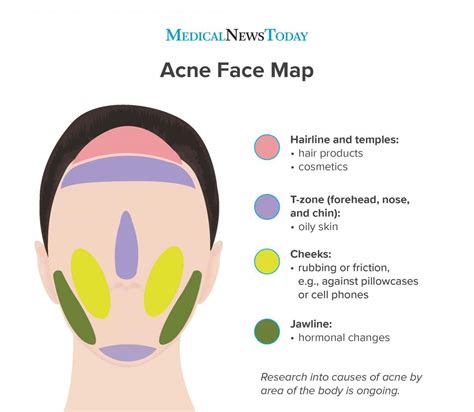 Face mapping comes from ancient Chinese and Ayurvedic medicine. The traditional method links ...