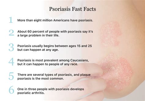 Psoriasis | Symptoms, Causes, Types and Treatments