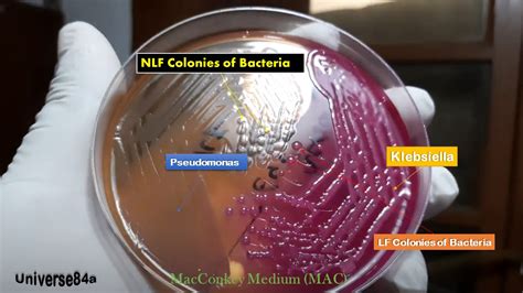 Colony Characteristics of Bacteria: Introduction, Types and Special Feature