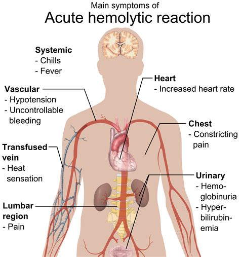 File:Main symptoms of acute hemolytic reaction.png - Wikipedia, the free encyclopedia