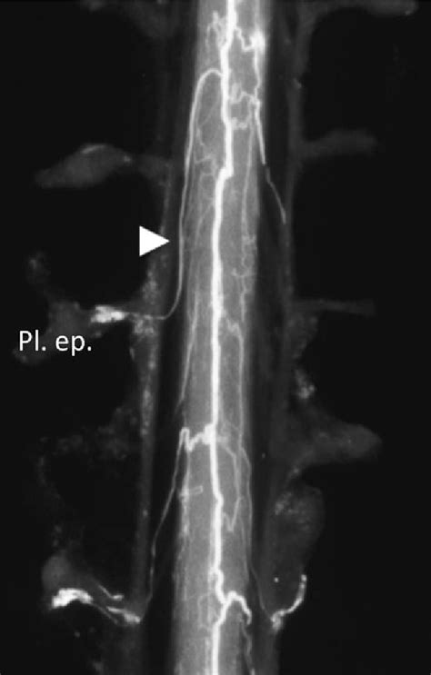 Structure of internal vertebral venous plexus | Semantic Scholar